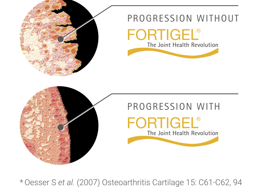 colágeno - fortigel