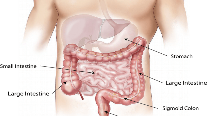 Cáncer de estómago